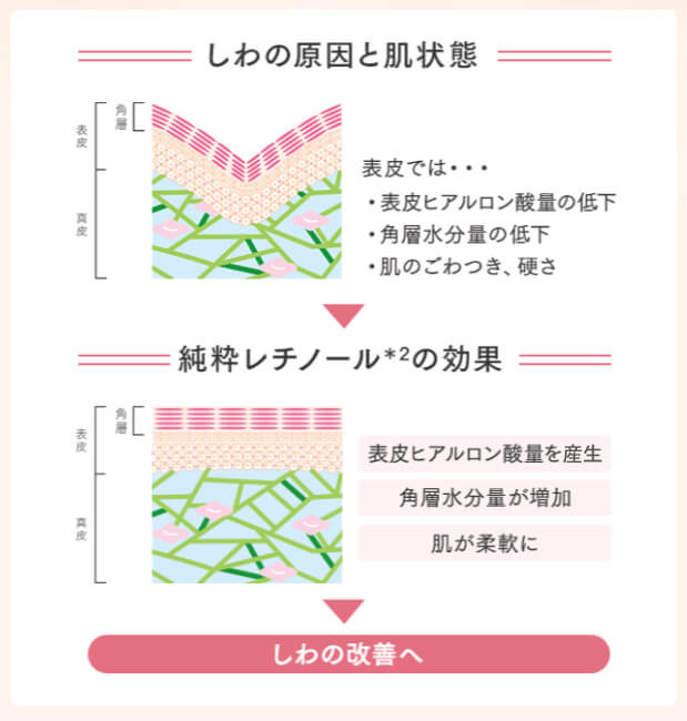 しわの原因と肌状態/純粋レチノールの効果