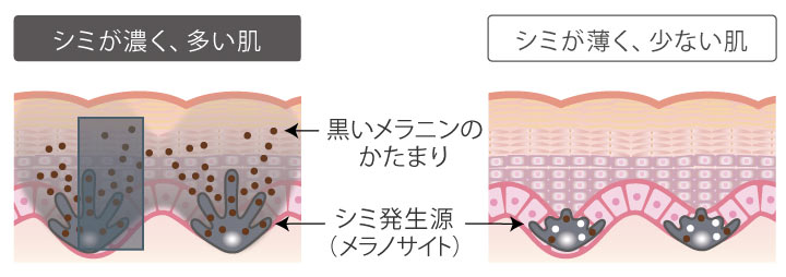 シミが濃く、多い肌 黒いメラニンのかたまり シミ発生源(メラノサイト) シミが薄く、少ない肌