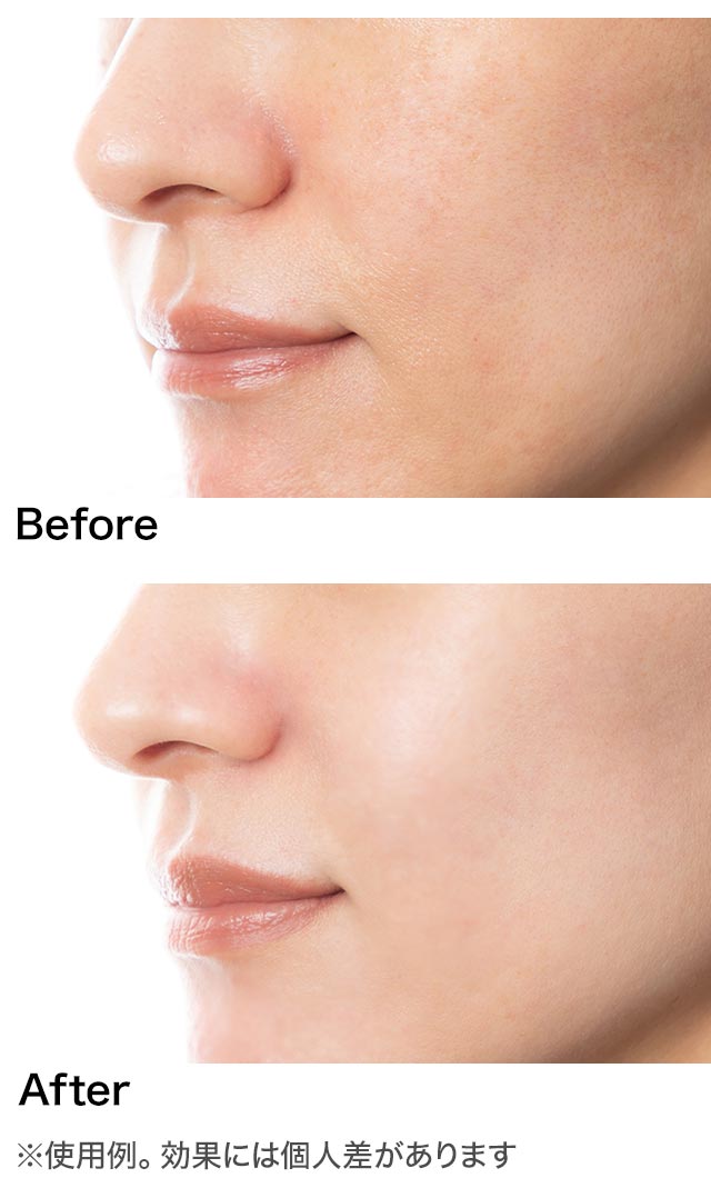  Before After ※使用例。効果には個人差があります