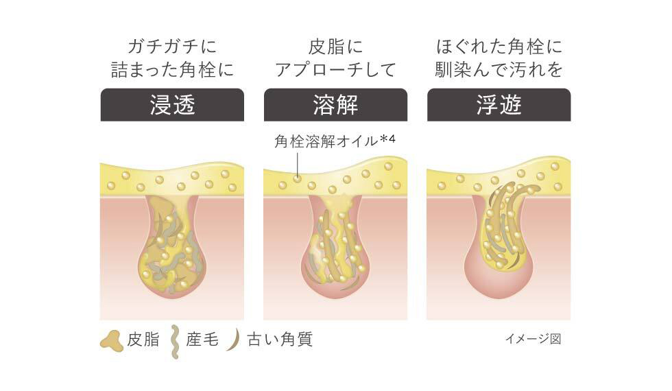 角栓溶解オイルが頑固な皮脂詰まりに直接アプローチ!