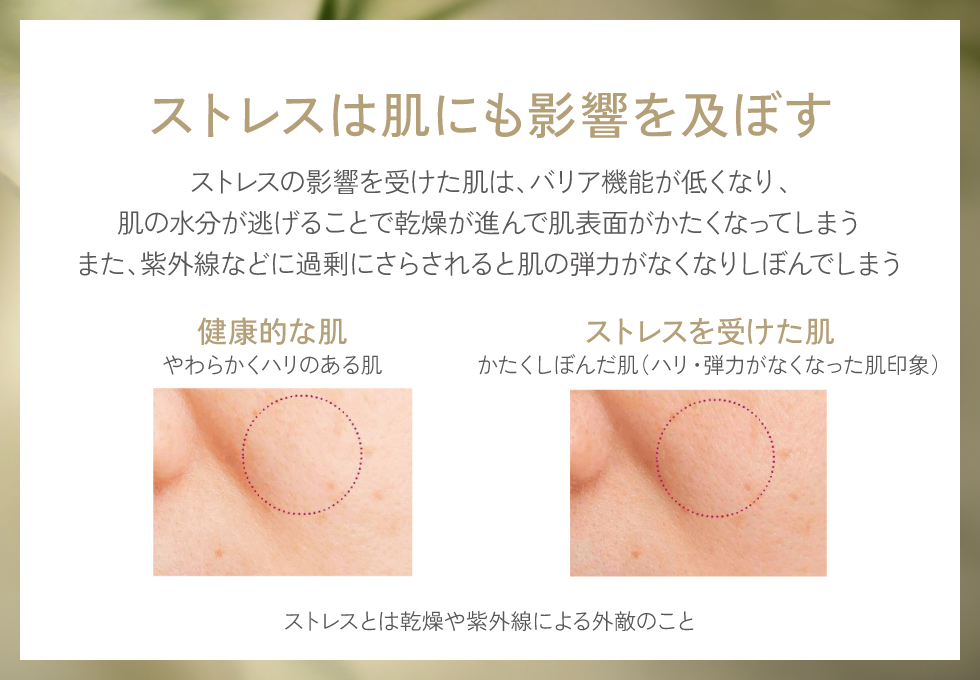 ストレスは肌にも影響を及ぼす