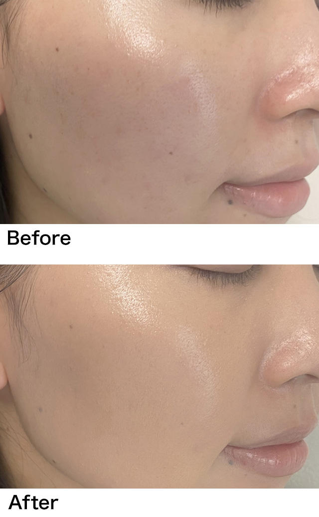 BEFORE AFTER