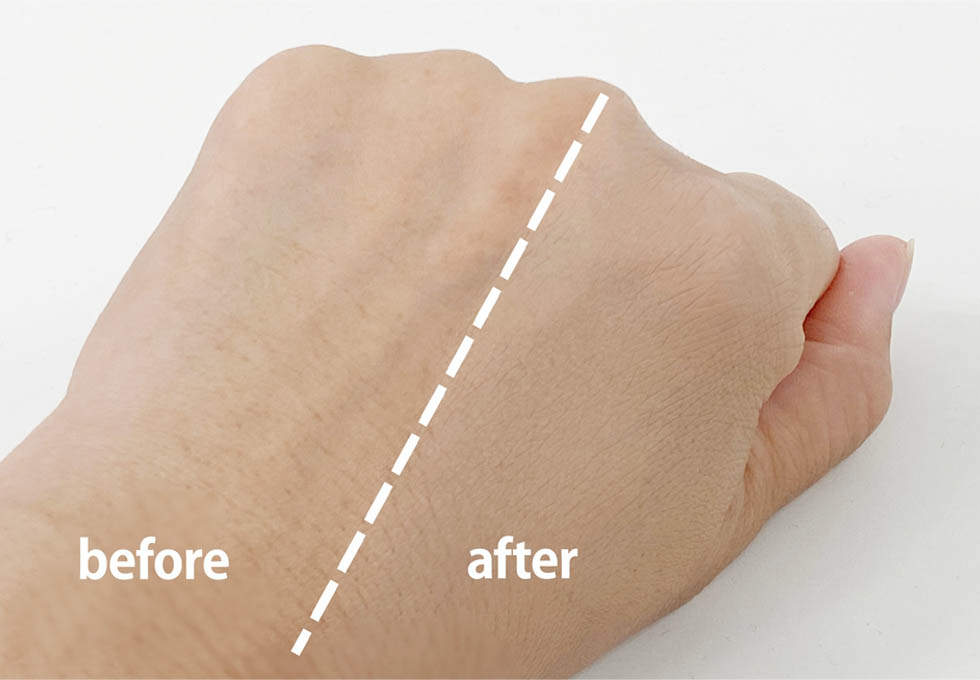 before after