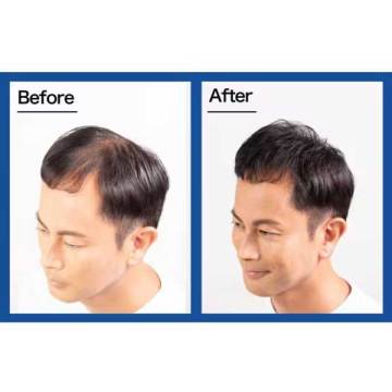 スーパーミリオンヘアー 02