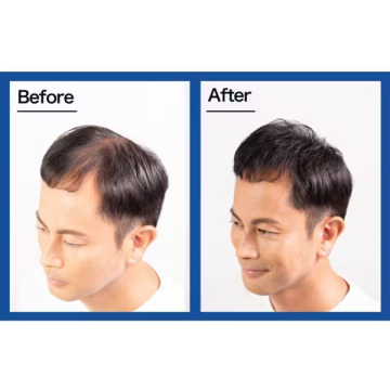 スーパーミリオンヘアー 02