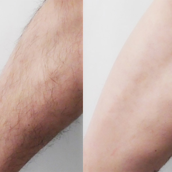 パインアンドソイ ヘアリムーバークリーム / アスティ コスメフリーク