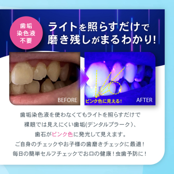 デンタルプラークチェックライト 05