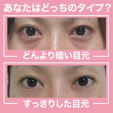 アイスラッククロフィートネオ 04