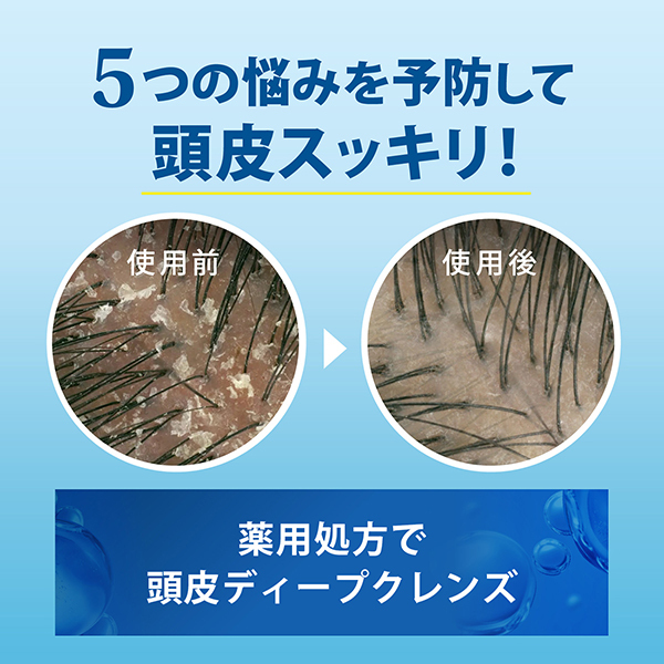 5in1 コンディショナー / h&s(エイチ アンド エス)(コンディショナー