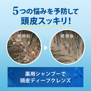 5in1 マイルドモイスチャー シャンプー 03