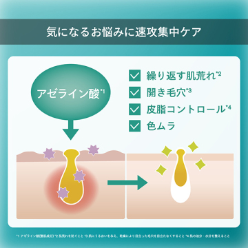 スマートアクティベーター 04