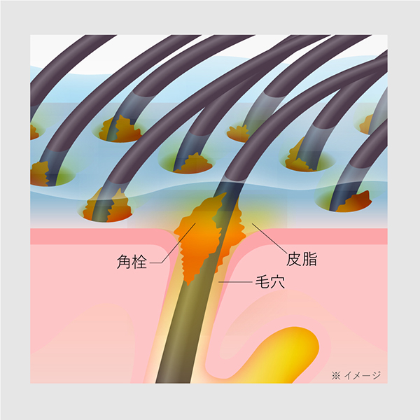 【数量限定】クラリファイイング スカルプジェル セット / 250g、2.5g×4 1