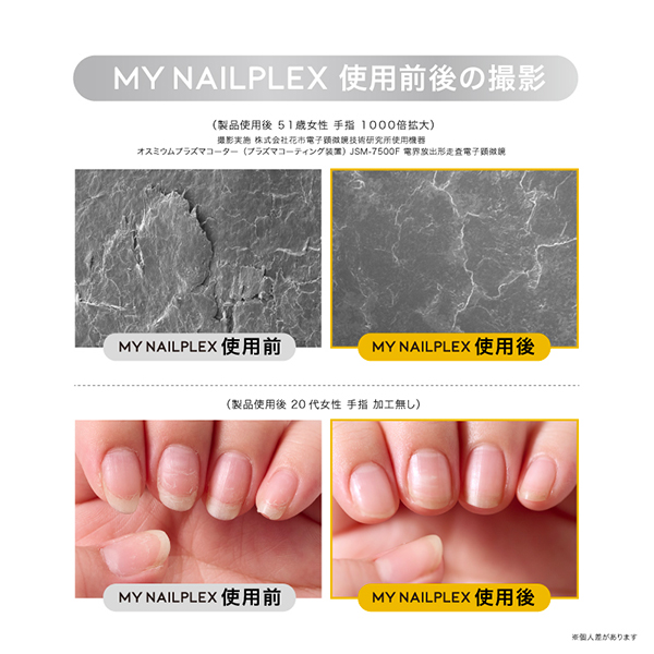 MY NAILPLEX / 10mL / ベルガモット&レモン / 潤うのにベタつかない 1