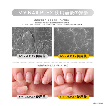 MY NAILPLEX 04