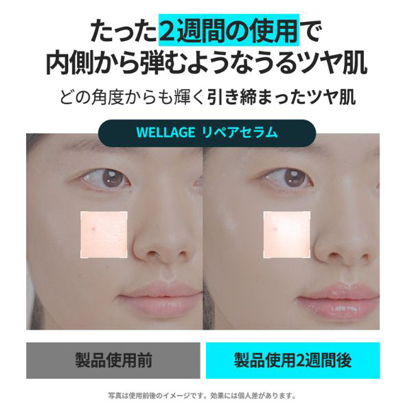 HYPER PDRN REPAIR AMPOULE / WELLAGE(ブースター・導入液, スキンケア