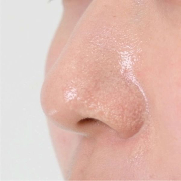 毛穴フォーカス メルトクレンジングオイル 04