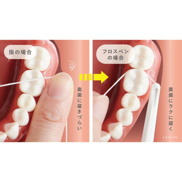 フロスペン ホワイト 口臭予防パッケージ 03